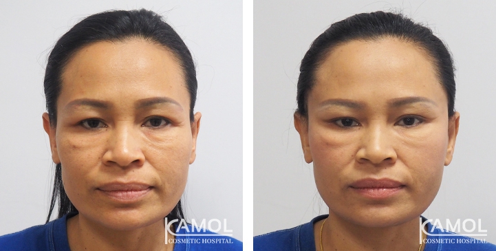 lg-649495957e9c7-image