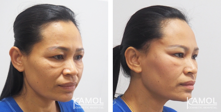 lg-64949595852cb-image