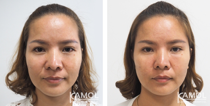 lg-649495958a1ee-image