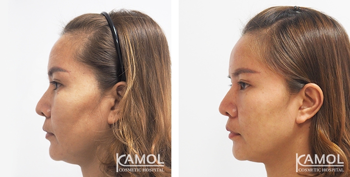 lg-649495958eaeb-image