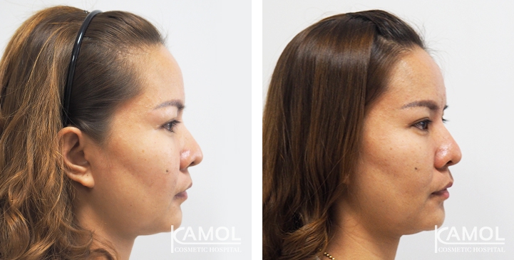 lg-6494959593542-image