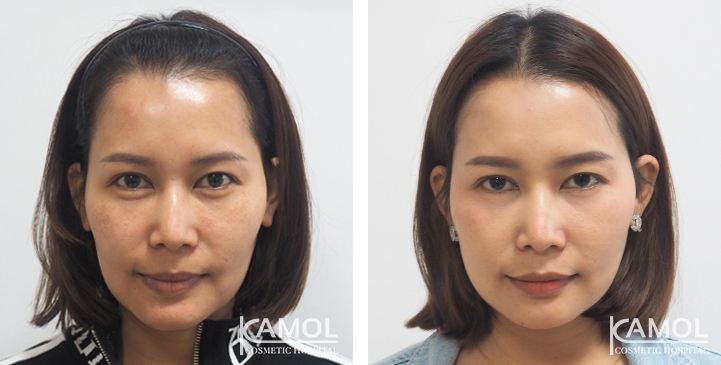 lg-64949595979c5-image