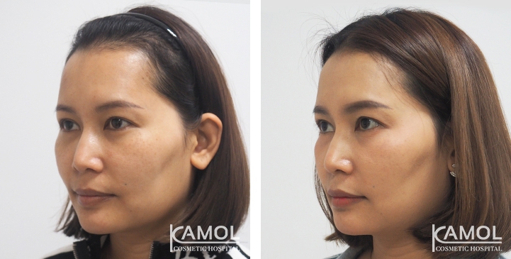 lg-6494959599cdd-image