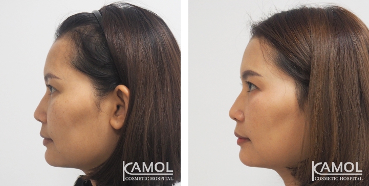 lg-649495959bc0c-image