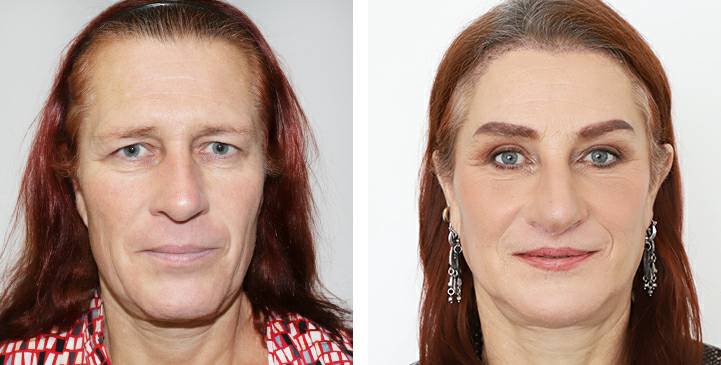 lg-64949595a3704-image