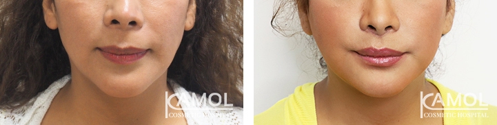 lg-64949595aa719-image