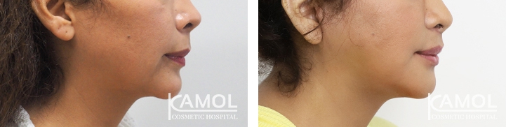 lg-64949595b2811-image