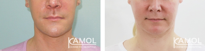 lg-64949595b521c-image