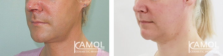 lg-64949595b7045-image