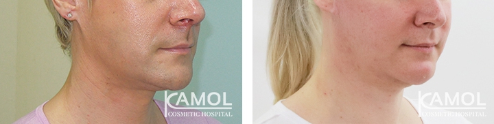 lg-64949595bb13a-image