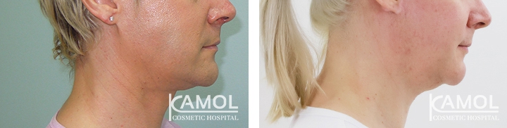 lg-64949595bd239-image