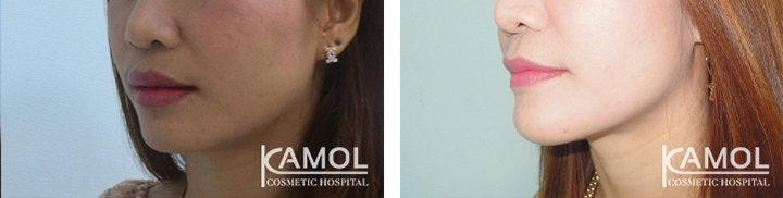 lg-649495968804e-image