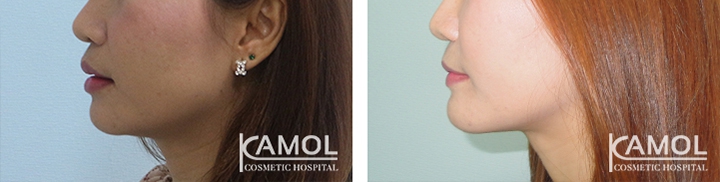 lg-649495968b480-image