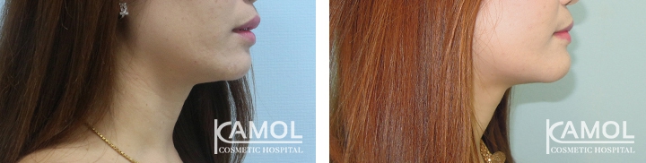 lg-6494959690af5-image