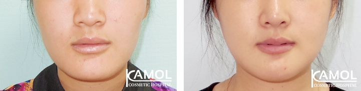 lg-64949596936ed-image