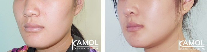 lg-64949596955fa-image