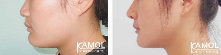 lg-649495969767b-image