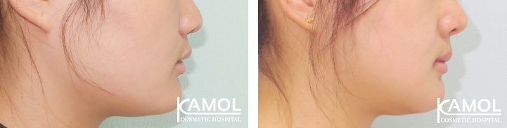 lg-649495969b147-image