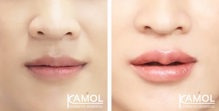 lg-649495969df1a-image