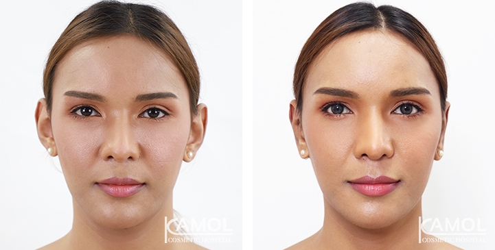 lg-64949596abcb0-image