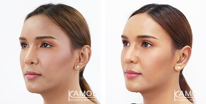 lg-64949596adf11-image