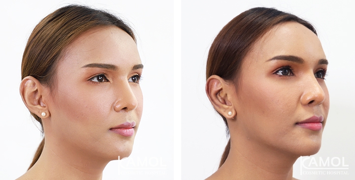 lg-64949596b2191-image