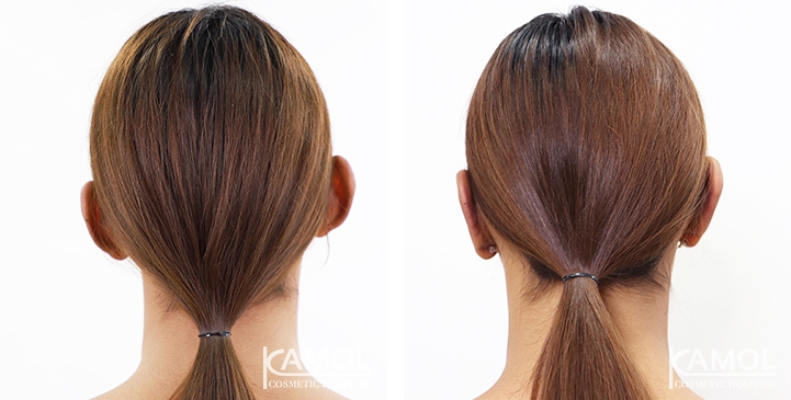 lg-64949596b6068-image