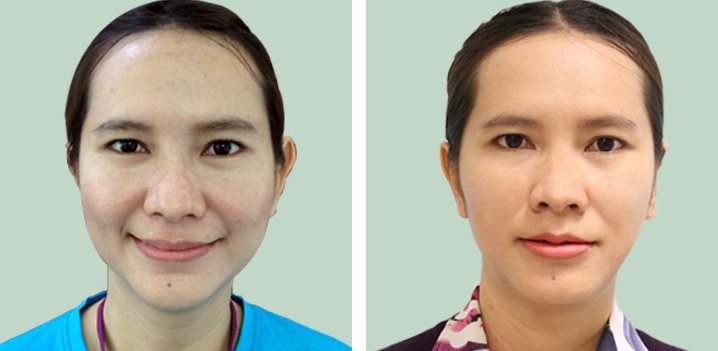 lg-64949596b8d16-image