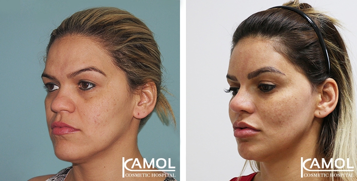 lg-649495972dbdf-image