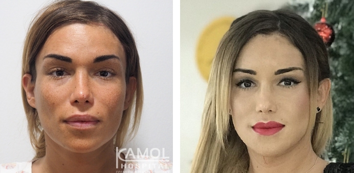 lg-6494959734d2d-image