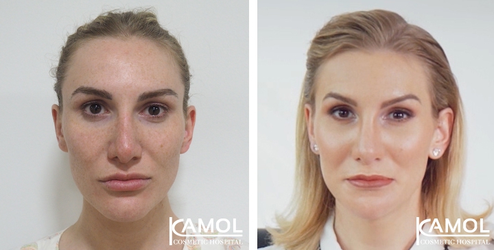 lg-64949598e990e-image