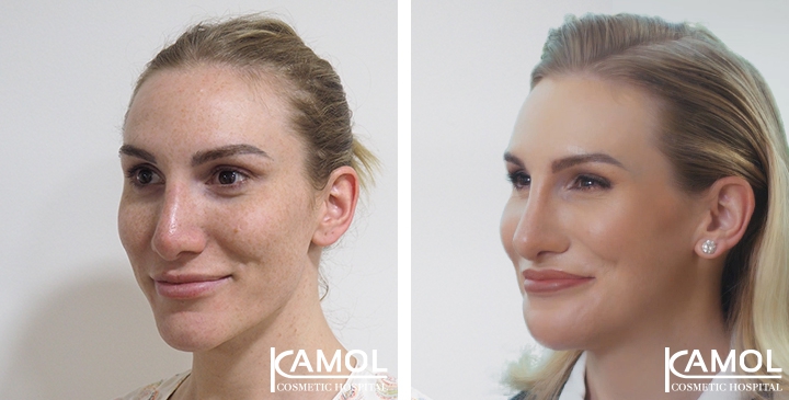 lg-64949598eb273-image