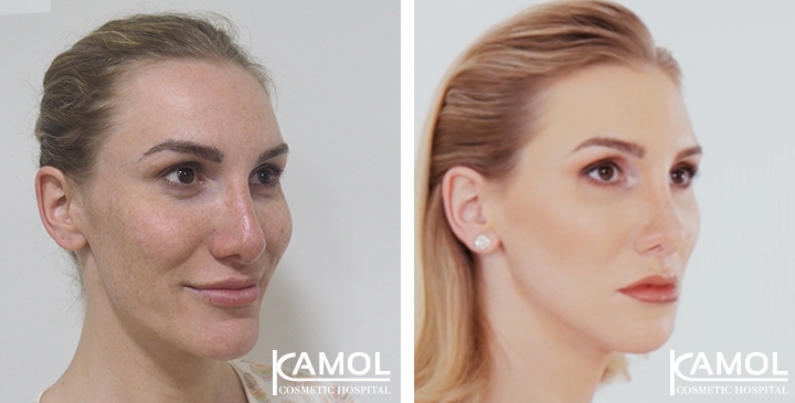 lg-64949598efb5f-image