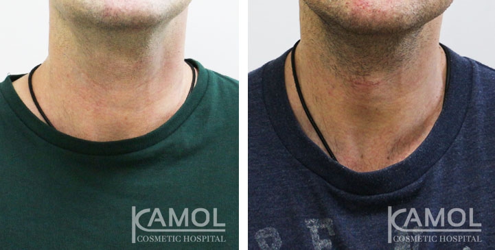 lg-6494959932ce7-image