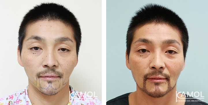 lg-649495993902a-image