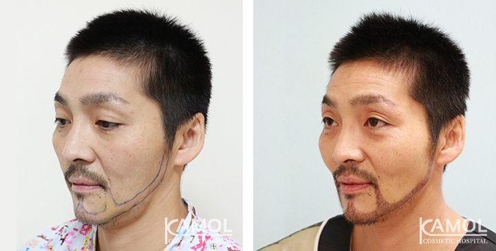 lg-649495993af26-image