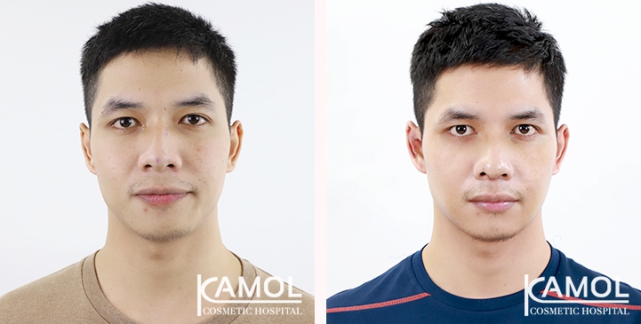 lg-6494959952c7e-image