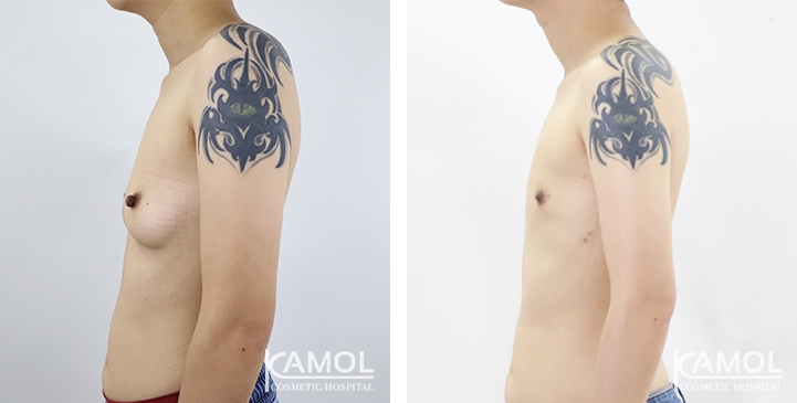 lg-64949599641e6-image