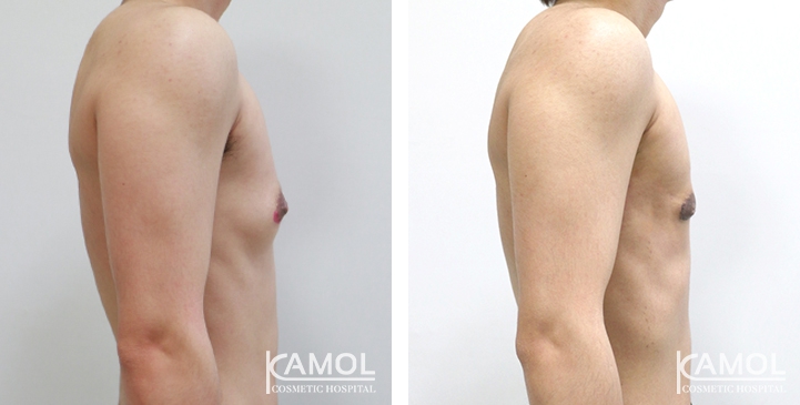 lg-6494959973589-image