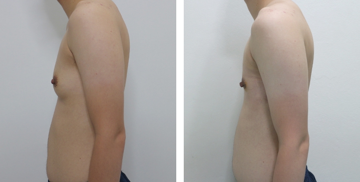 lg-6494959985179-image