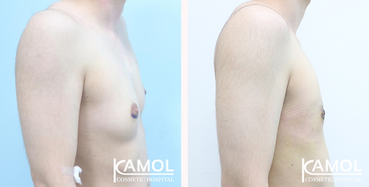 lg-6494959993805-image