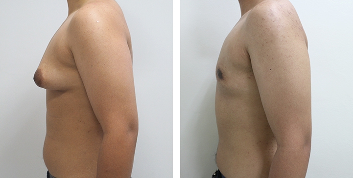 lg-64949599b45d6-image