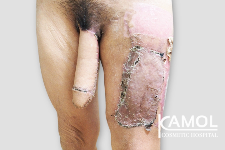 lg-64949599f40b3-image