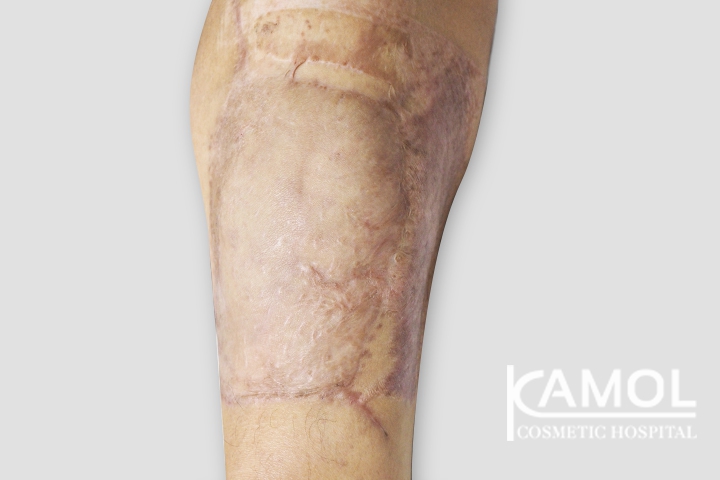 lg-6494959a0e3aa-image