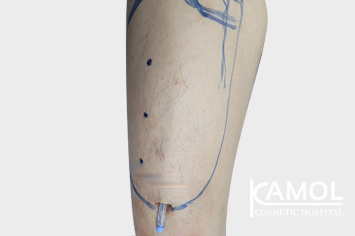 lg-6494959a2f630-image