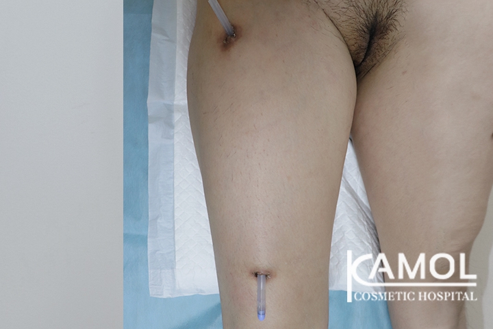 lg-6494959a315e5-image