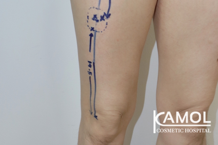 lg-6494959a33542-image