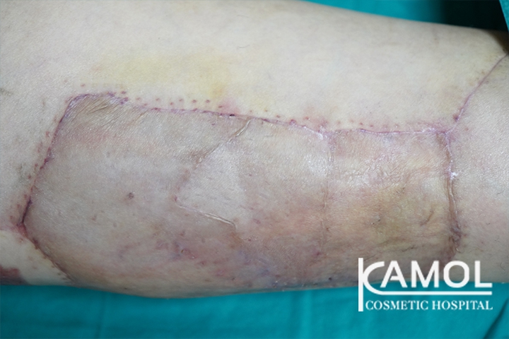 lg-6494959a36fd2-image