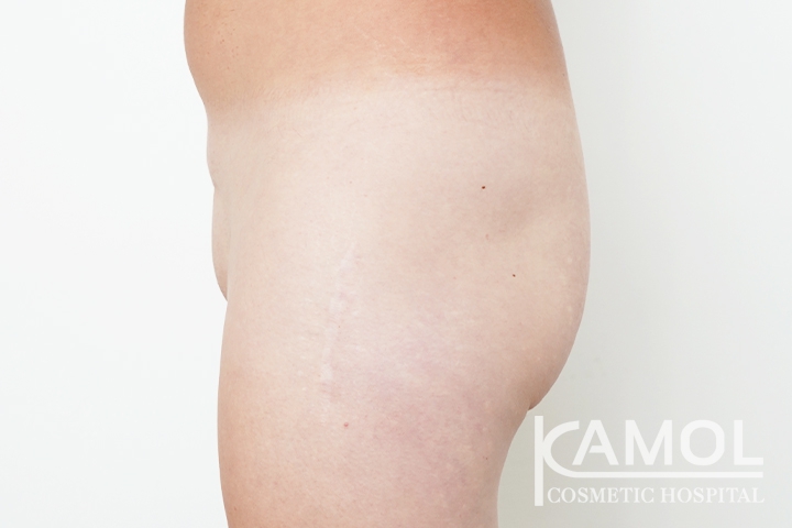 lg-6494959a59d72-image