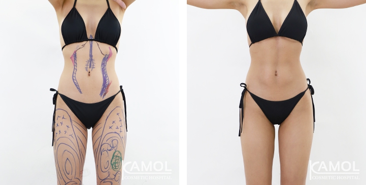 lg-6494959a602bc-image